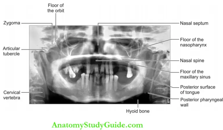 Extraoral Radiographic Techniques - Anatomy Study Guide