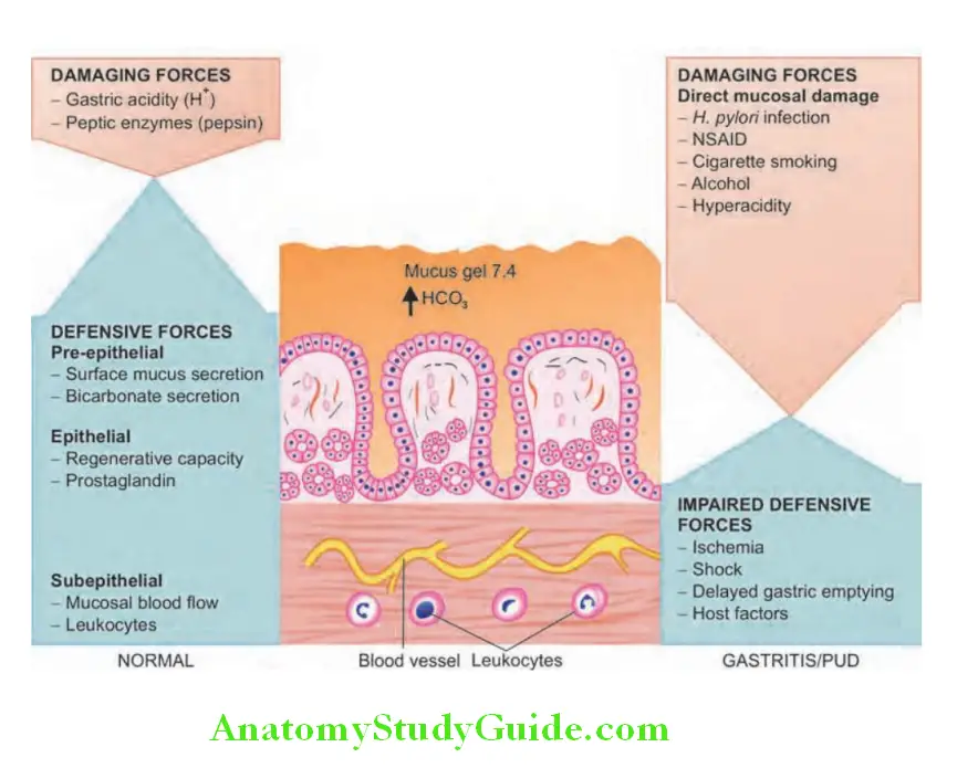 Gastroenterology Components involved in mucosal defense and repair in normal (left side) and in acute or chronic gastritis