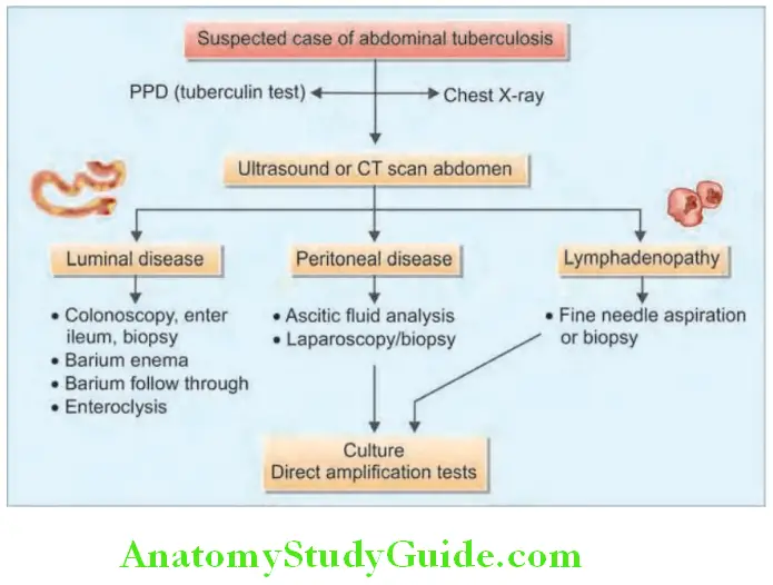 Gastroenterology Diagnostic algorithm for abdominal tuberculosis