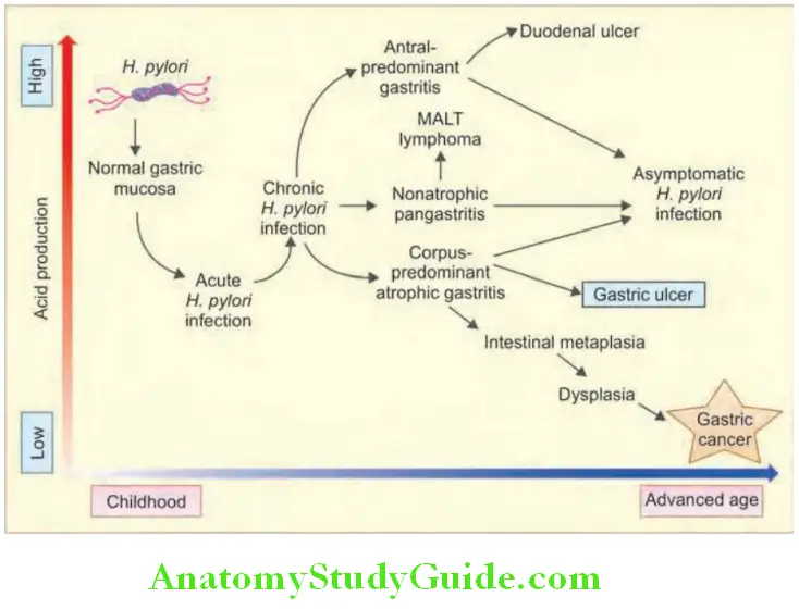 Gastroenterology Natural history of H. pylori infection