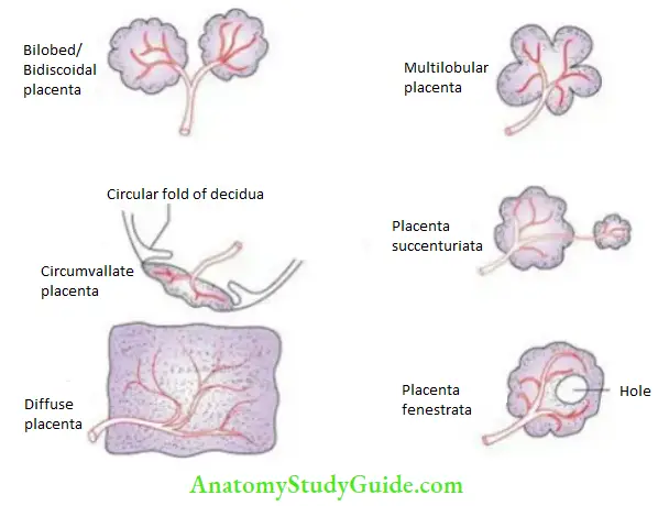 General embryology Anomalies of placenta due to shapes.