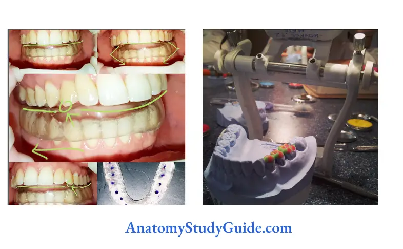 Gnathologic Instrumentation Short Notes - Anatomy Study Guide