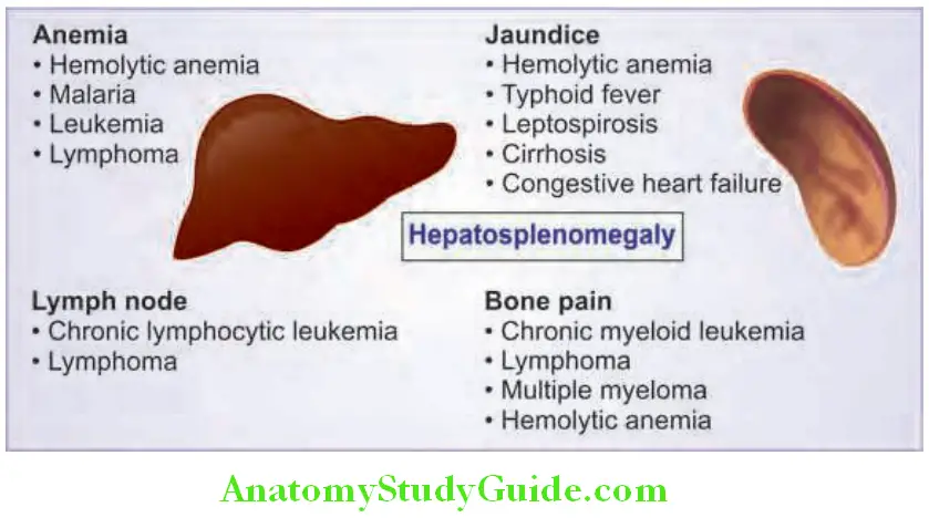 Hepatobiliary System Causes of hepatosplenomegaly according to the associated sign