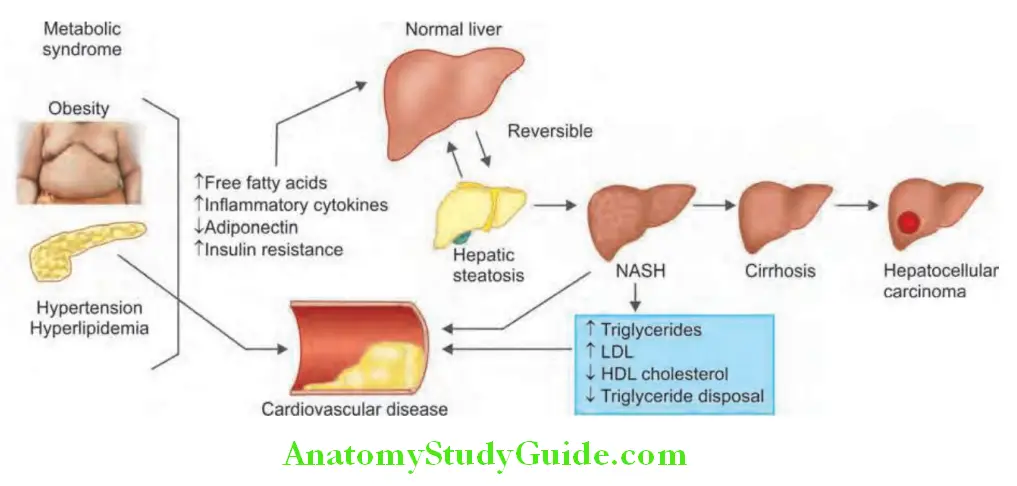 Hepatobiliary System Pathogenesis of nonalcoholic fatty liver disease