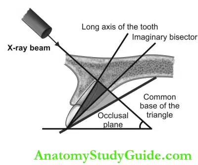 Intraoral Radiographic Techniques Bisecting Angle Technique Principle