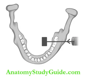 Intraoral Radiographic Techniques Mandibular Molar Projection