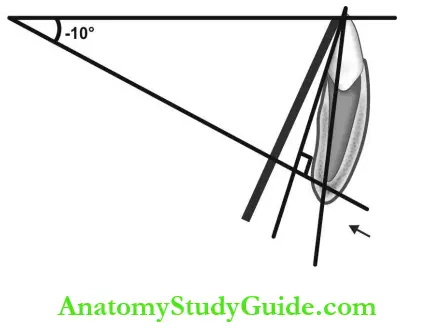 Intraoral Radiographic Techniques Mandibular Premolar Projection