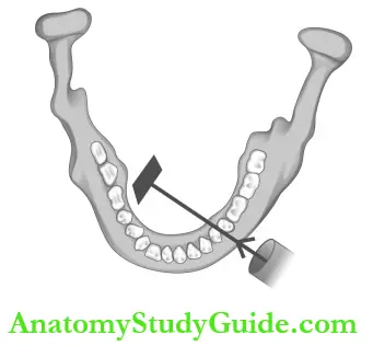 Intraoral Radiographic Techniques Mandibular Premolar Projection