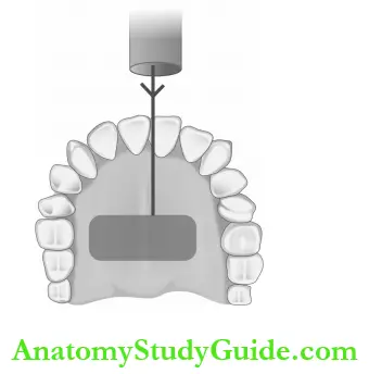 Intraoral Radiographic Techniques Maxillary Incisor Projection