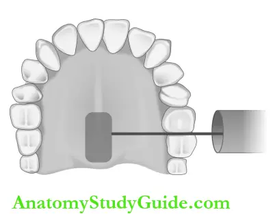 Intraoral Radiographic Techniques Maxillary Molar Projection