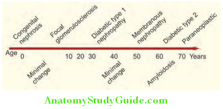 Kidney Etiology of nephrotic syndrome by age