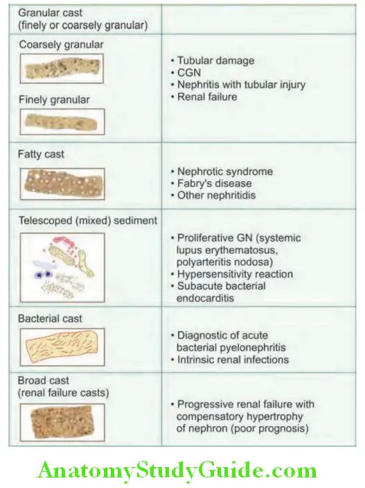 Kidney Urinary casts and their signifiance.