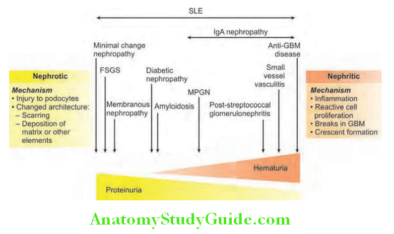 Kidney Various causes of proliferative and nonproliferative glomerulonephritis
