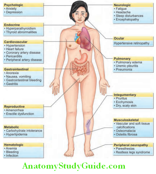 Kidney Various clinical manifestations of chronic kidney disease CKD