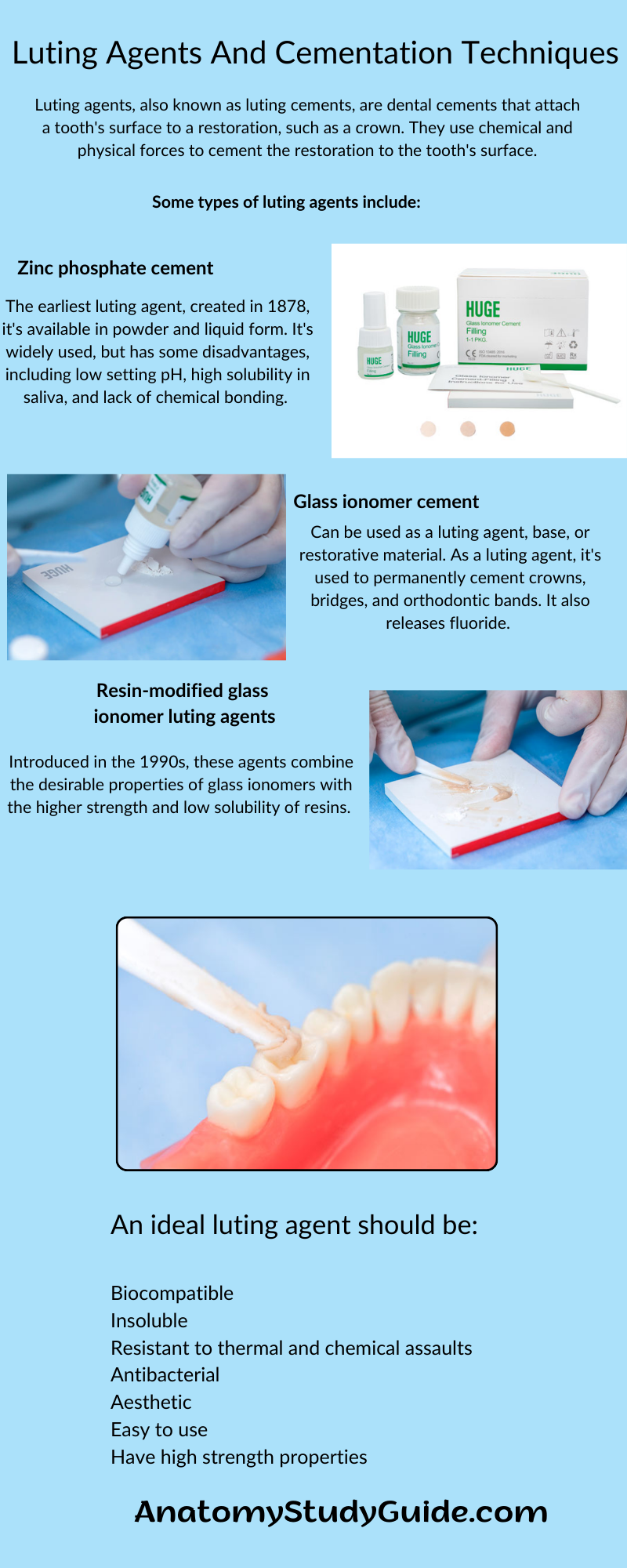 Luting Agents And Cementation Techniques
