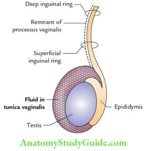 Male External Genital Organs Hydrocele