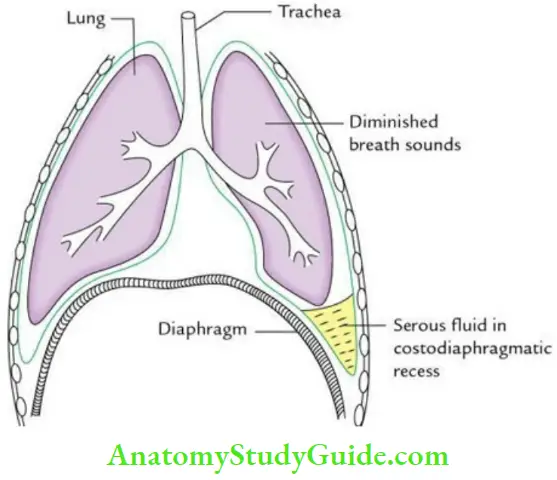 Mediastinum And Pleura Pleura Effusion In Left Costo Diaphragmatic Recess