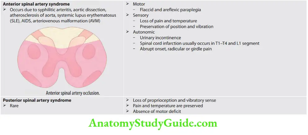 Neurology Anterior spinal artery occlusion