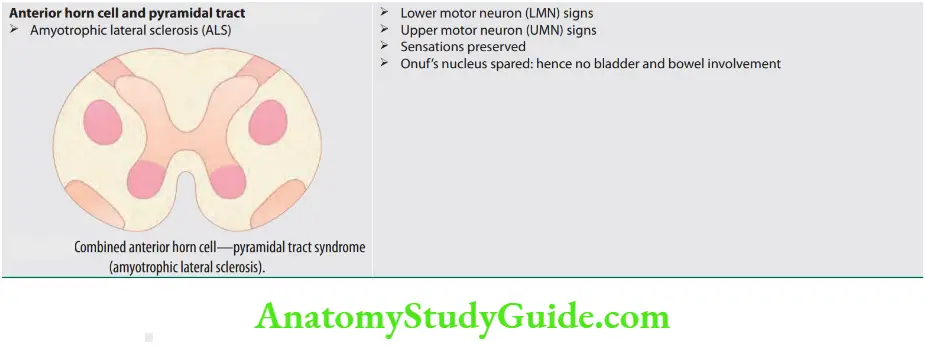 Neurology Combined anterior horn cell