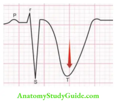 Neurology Electrocardiographic (ECG) changes.