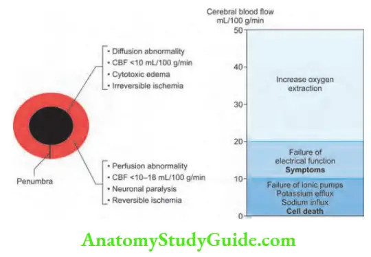 Neurology Ischemic penumbra and ischemic core