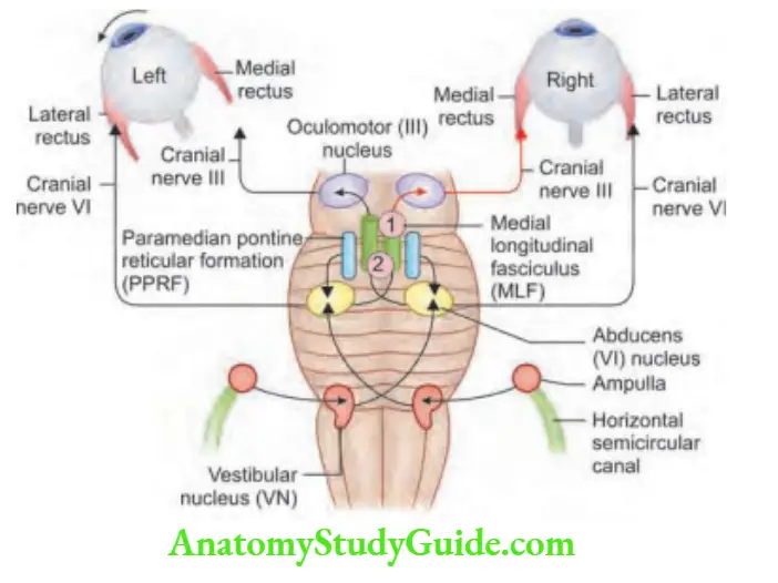 Neurology Lesions of medial longitudinal fasciculus (MLF).