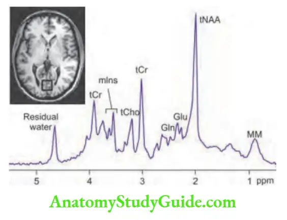 Neurology Magnetic resonance spectroscopy of brain.