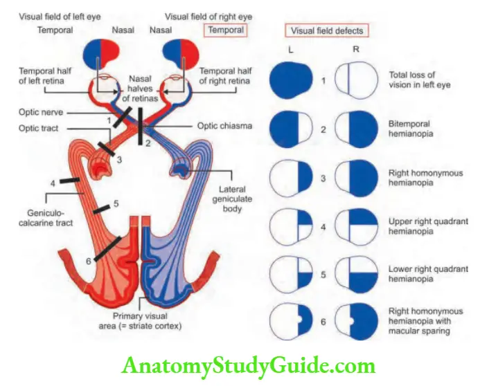 Neurology Various visual fild defects depending on the location of lesion.