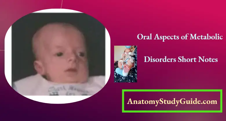 Oral Aspects of Metabolic Disorders Short Notes