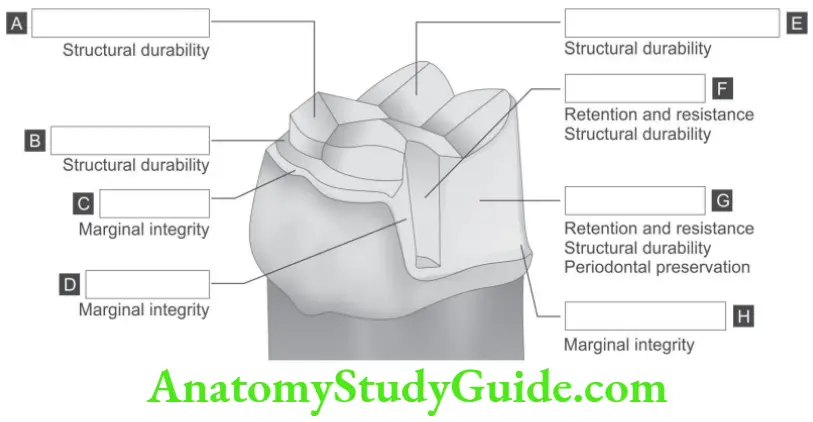 Partial Denture Partial Coverage Restorations Molar teeth
