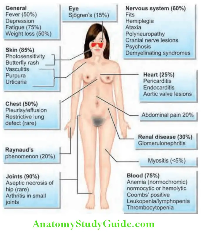 Rheumatology and Connective Tissue Disorders Clinical features of systemic lupus erythematosus
