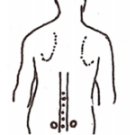 Treatment Of Common Diseases Two Shallow Round Depressions On Both Sides Of The Spine