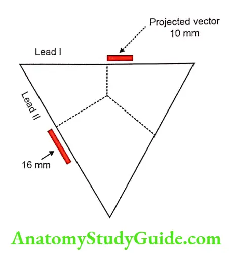 Vector notes Determination of vector in lead 1 and lead 2