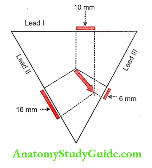 Vector notes calculation of cardiac vector