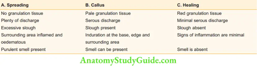 Differential Diagnosis Of Leg Ulcer And Pressure Sore Clinical Classification