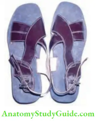 Differential Diagnosis Of Leg Ulcer And Pressure Sore Microcellular Rubber Chappals