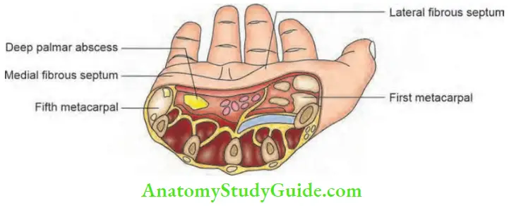Hand Foot Infections And Tendon Transfer Cross Section Showing Deep Palmar Space