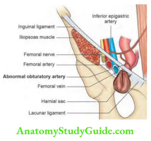 Herina Femoral Herina Anatomy