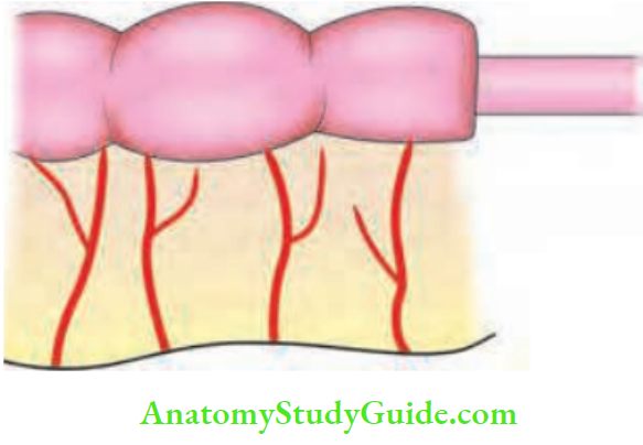 Intestinal Obstruction Gries Field Type 1