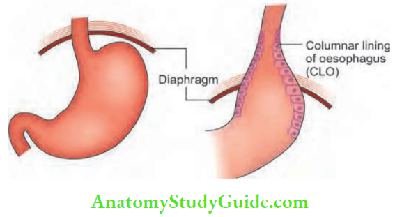 Oesophagus And Diaphragm Normal Position And Sliding Hemla