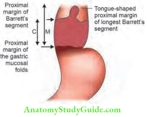 Oesophagus And Diaphragm Prague Classification