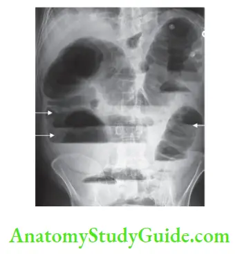 Principles of Radiology, Viva Voce Examination Notes, Question And ...