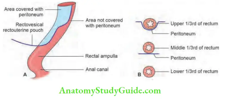 Carcinoma Rectum And Anal Canal Laparoscopic Notes - Anatomy Study Guide