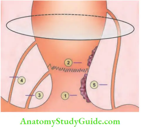 Rectum And Anal Canal Standard Classification