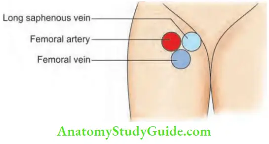 Varicose Veins And Deep Vein Thrombosis Mickey Mouse Sign As Seen In Duplex Ultrasound