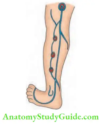 Varicose Veins And Deep Vein Thrombosis Short Saphenous Vein And Its Perforators