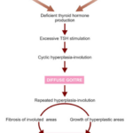 The Endocrine System Pathogenesis of simple and nodular goitre.