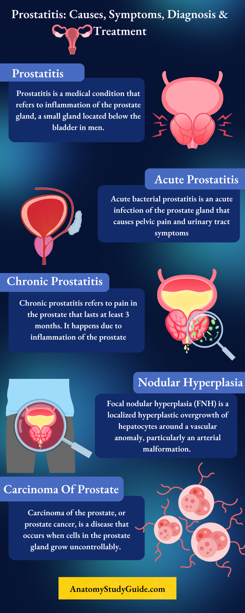 Prostatitis Causes Symptoms Diagnosis And Treatment